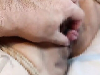 I Aspirate M Woman Clitoris and Am Fixed with Rubber